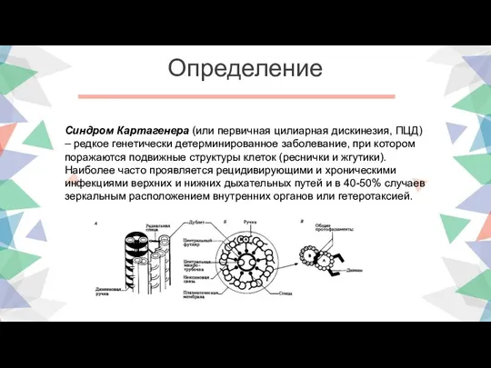 Определение Синдром Картагенера (или первичная цилиарная дискинезия, ПЦД) – редкое