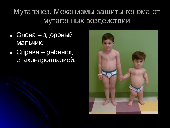 Мутагенез. Механизмы защиты генома от мутагенных воздействий Слева – здоровый мальчик. Справа – ребенок, с ахондроплазией.