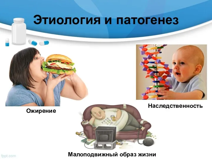 Этиология и патогенез Малоподвижный образ жизни Ожирение Наследственность