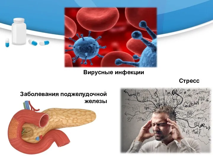 Стресс Заболевания поджелудочной железы Вирусные инфекции