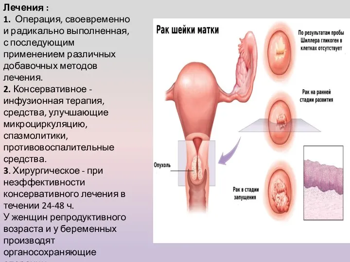 Лечения : 1. Операция, своевременно и радикально выполненная, с последующим