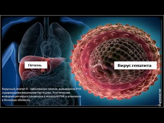 Вирусный гепатит D - заболевание печени, вызываемое РНК содержащими вирусными
