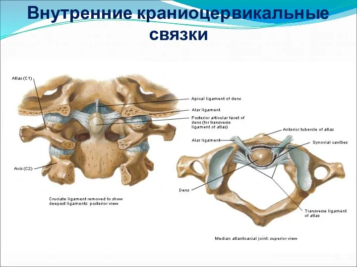 Внутренние краниоцервикальные связки