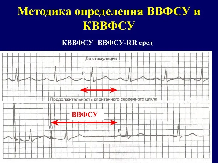 Методика определения ВВФСУ и КВВФСУ КВВФСУ=ВВФСУ-RR сред ВВФСУ