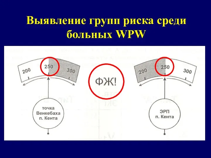 Выявление групп риска среди больных WPW