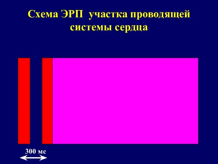 Схема ЭРП участка проводящей системы сердца 300 мс