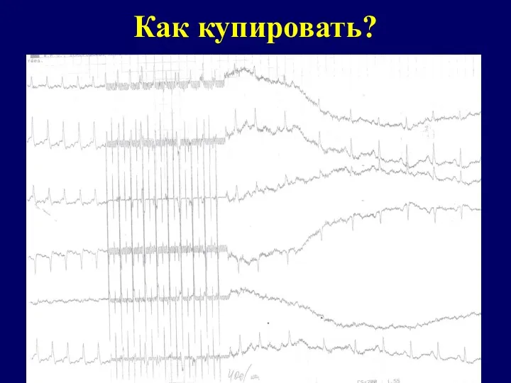 Как купировать?