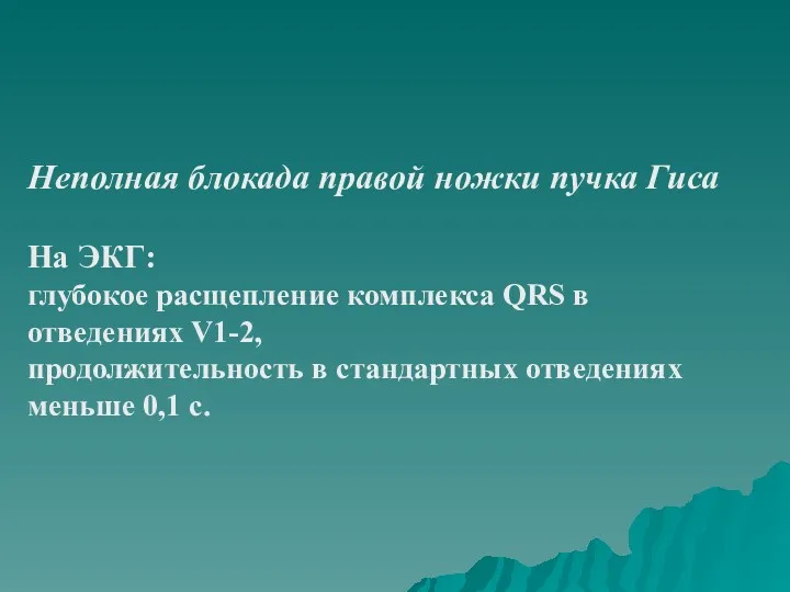 Неполная блокада правой ножки пучка Гиса На ЭКГ: глубокое расщепление