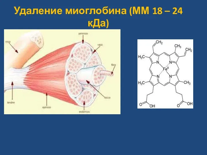 Удаление миоглобина (ММ 18 – 24 кДа)