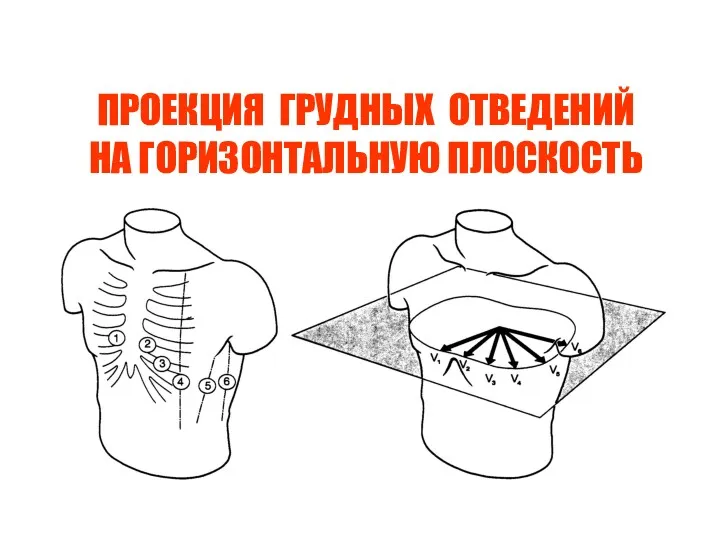 ПРОЕКЦИЯ ГРУДНЫХ ОТВЕДЕНИЙ НА ГОРИЗОНТАЛЬНУЮ ПЛОСКОСТЬ