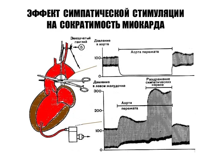 ЭФФЕКТ СИМПАТИЧЕСКОЙ СТИМУЛЯЦИИ НА СОКРАТИМОСТЬ МИОКАРДА