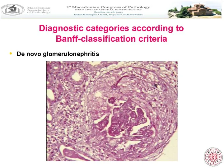 Diagnostic categories according to Banff-classification criteria De novo glomerulonephritis