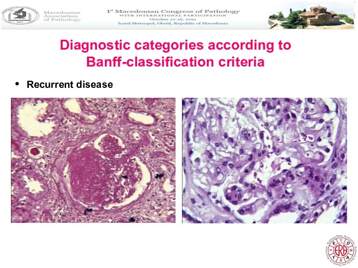 Diagnostic categories according to Banff-classification criteria Recurrent disease