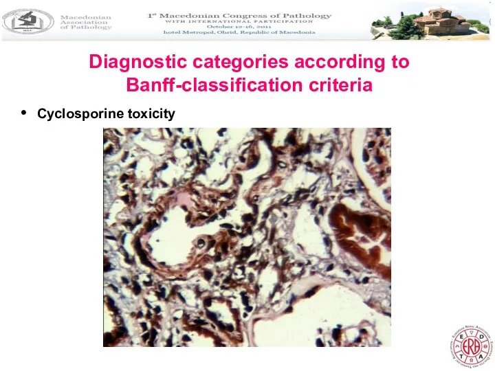 Diagnostic categories according to Banff-classification criteria Cyclosporine toxicity