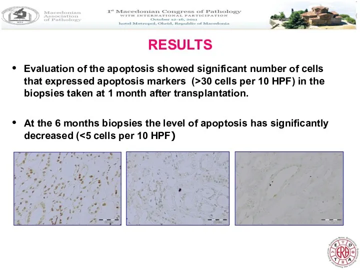 RESULTS Evaluation of the apoptosis showed significant number of cells