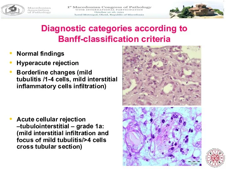 Diagnostic categories according to Banff-classification criteria Normal findings Hyperacute rejection