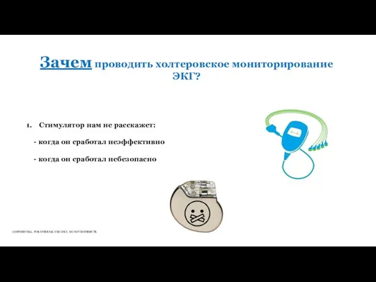 Зачем проводить холтеровское мониторирование ЭКГ? Стимулятор нам не расскажет: -