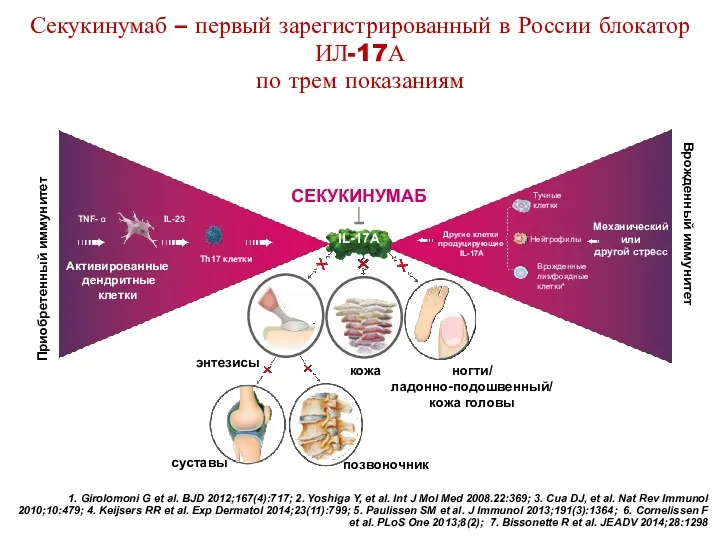 Секукинумаб – первый зарегистрированный в России блокатор ИЛ-17А по трем