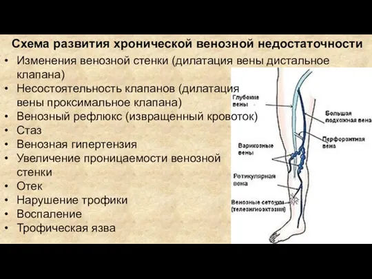 Несостоятельность клапанов (дилатация вены проксимальное клапана) Венозный рефлюкс (извращенный кровоток) Стаз Венозная гипертензия