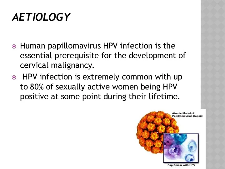AETIOLOGY Human papillomavirus HPV infection is the essential prerequisite for