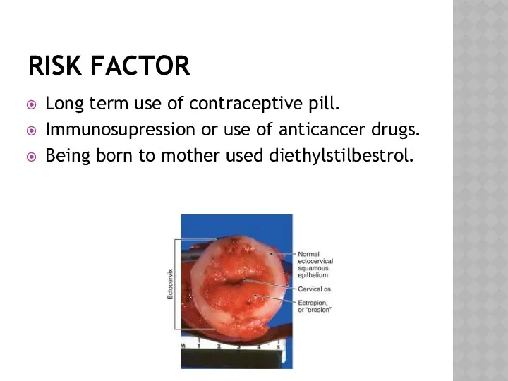 RISK FACTOR Long term use of contraceptive pill. Immunosupression or