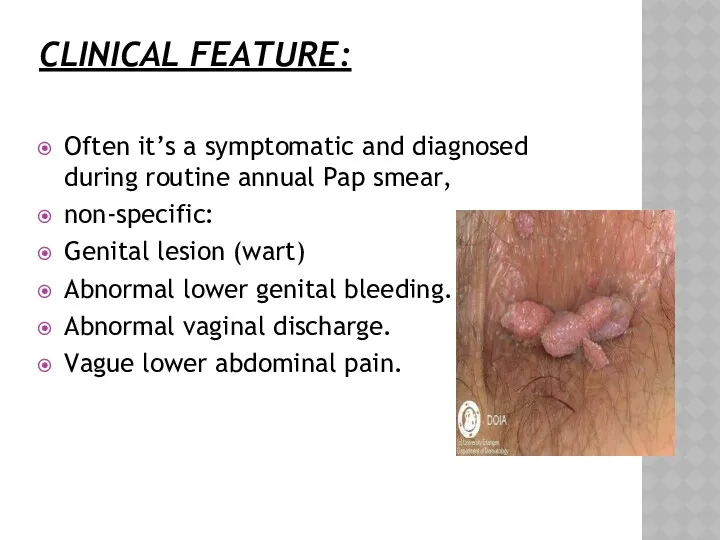 CLINICAL FEATURE: Often it’s a symptomatic and diagnosed during routine