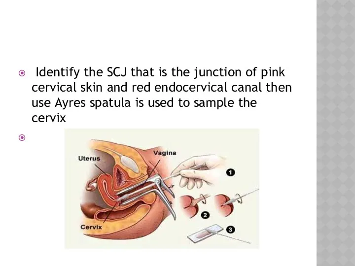 Identify the SCJ that is the junction of pink cervical