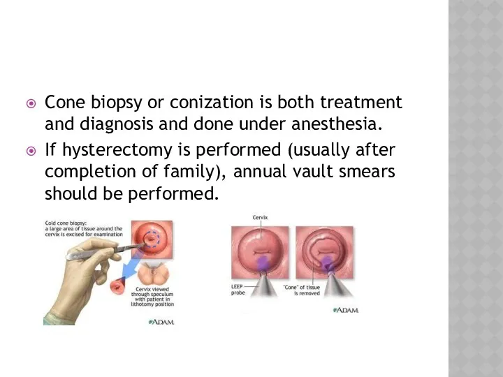 Cone biopsy or conization is both treatment and diagnosis and