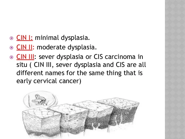 CIN I: minimal dysplasia. CIN II: moderate dysplasia. CIN III: