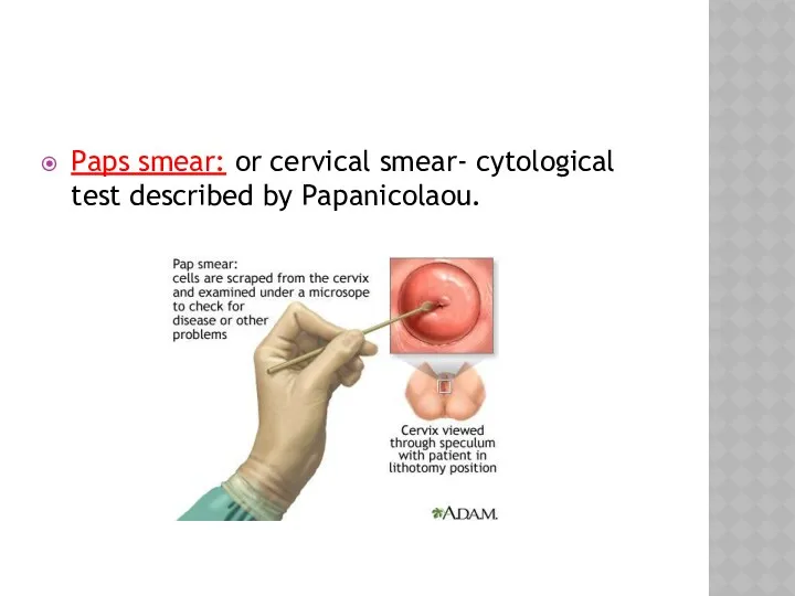 Paps smear: or cervical smear- cytological test described by Papanicolaou.