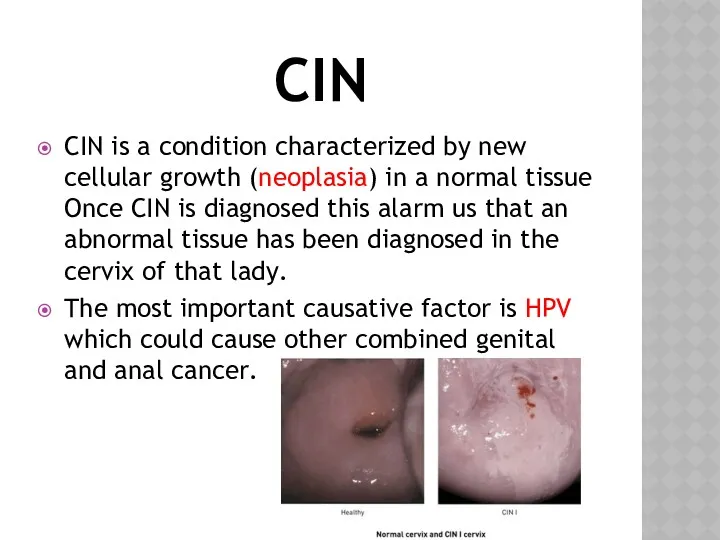 CIN CIN is a condition characterized by new cellular growth