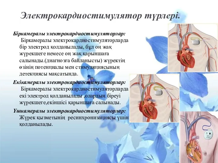 Электрокардиостимулятор түрлері. Біркамералы электрокардиостимуляторлар: Біркамералы электрокардиостимуляторларда бір электрод қолданылады, бұл