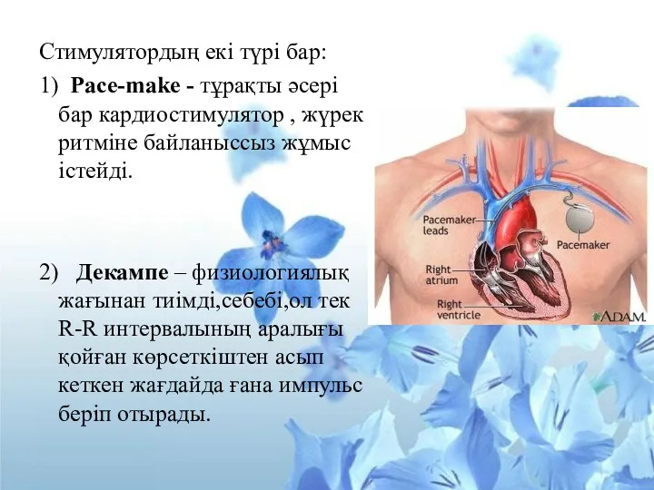 Стимулятордың екі түрі бар: 1) Pace-make - тұрақты әсері бар