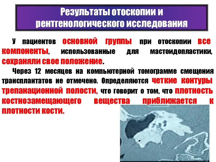 У пациентов основной группы при отоскопии все компоненты, использованные для