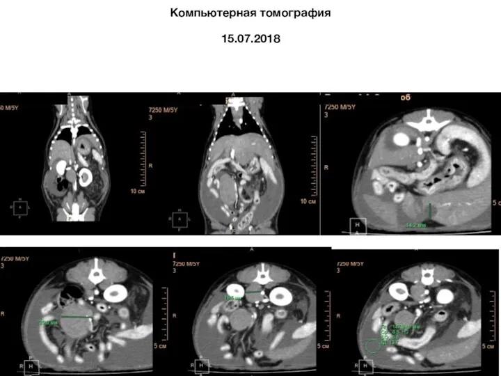 Компьютерная томография 15.07.2018