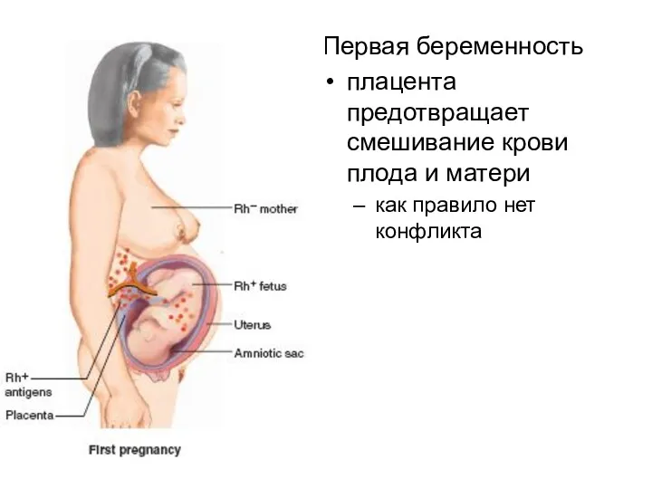 Первая беременность плацента предотвращает смешивание крови плода и матери как правило нет конфликта