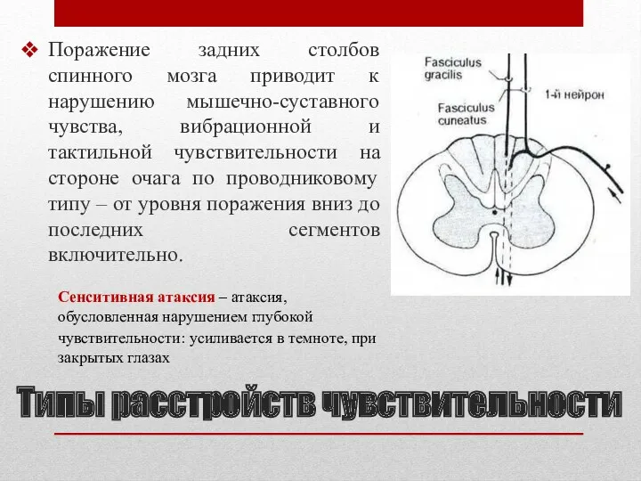 Поражение задних столбов спинного мозга приводит к нарушению мышечно-суставного чувства,