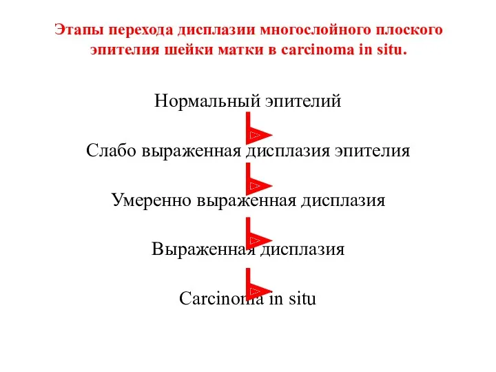 Этапы перехода дисплазии многослойного плоского эпителия шейки матки в carcinoma in situ. Нормальный