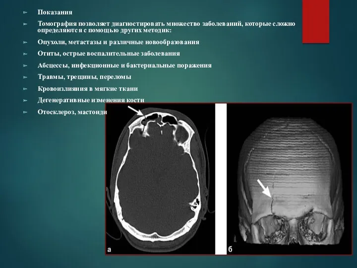 Показания Томография позволяет диагностировать множество заболеваний, которые сложно определяются с