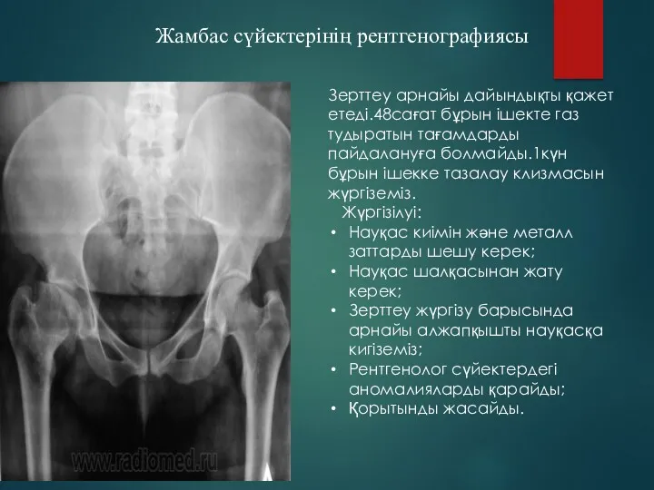 Жамбас сүйектерінің рентгенографиясы Зерттеу арнайы дайындықты қажет етеді.48сағат бұрын ішекте