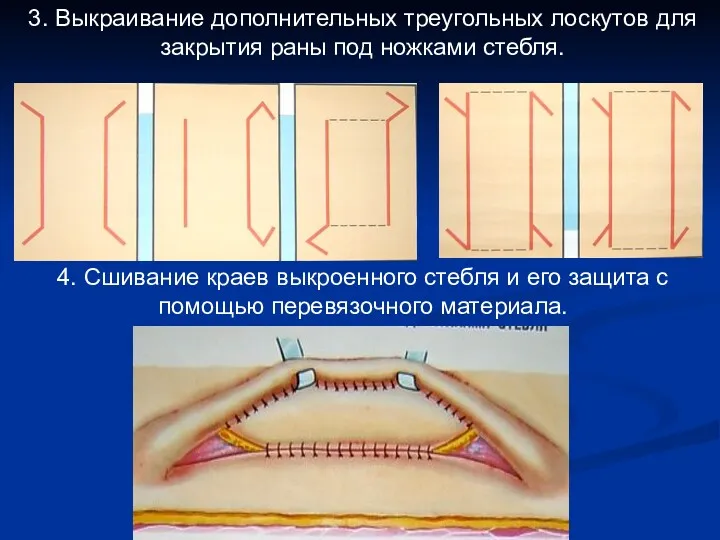 3. Выкраивание дополнительных треугольных лоскутов для закрытия раны под ножками