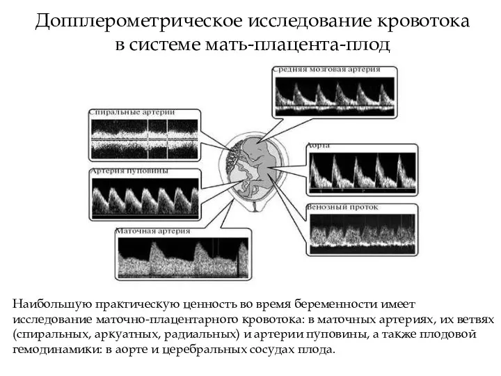 Допплерометрическое исследование кровотока в системе мать-плацента-плод Наибольшую практическую ценность во