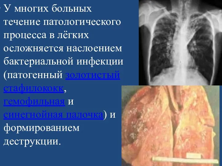 У многих больных течение патологического процесса в лёгких осложняется наслоением бактериальной инфекции (патогенный