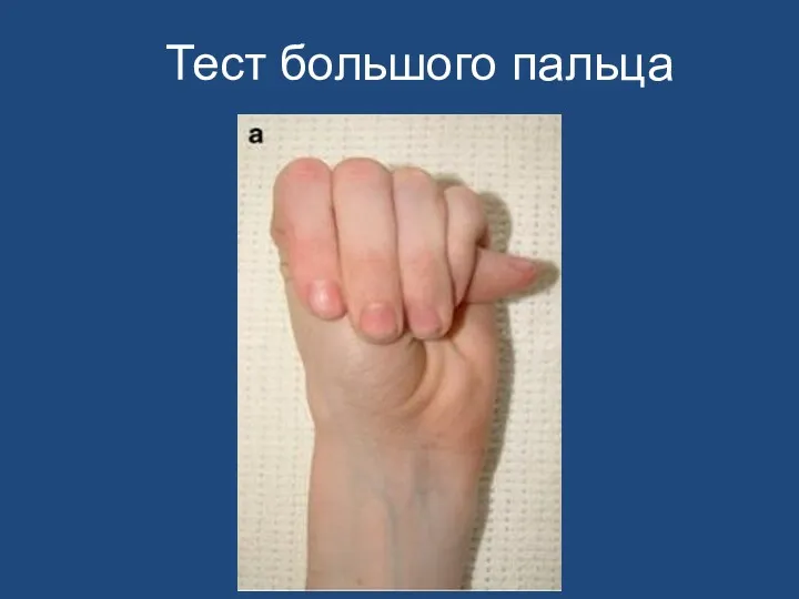 Тест большого пальца