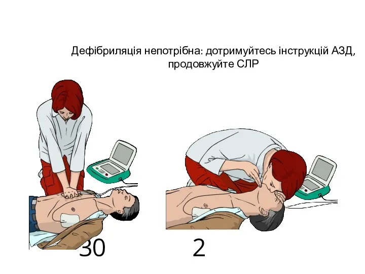 Дефібриляція непотрібна: дотримуйтесь інструкцій АЗД, продовжуйте СЛР 30 2