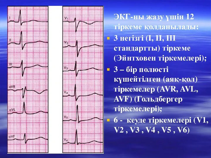 ЭКГ-ны жазу үшін 12 тіркеме қолданылады: 3 негізгі (І, ІІ,