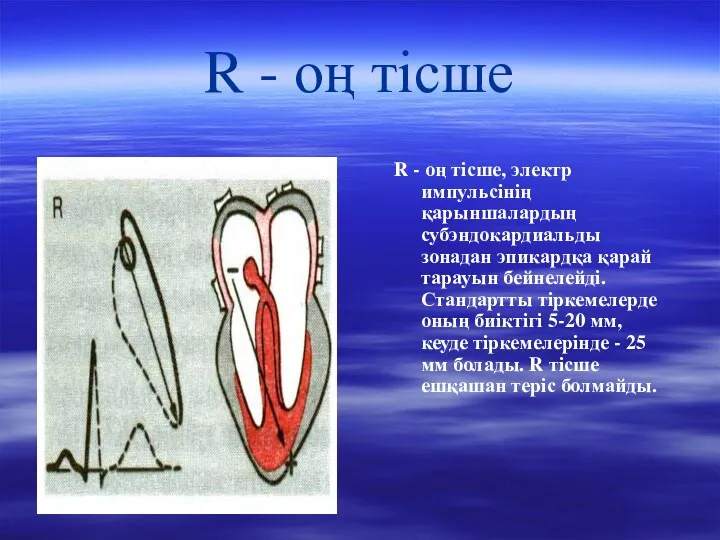 R - оң тісше R - оң тісше, электр импульсінің