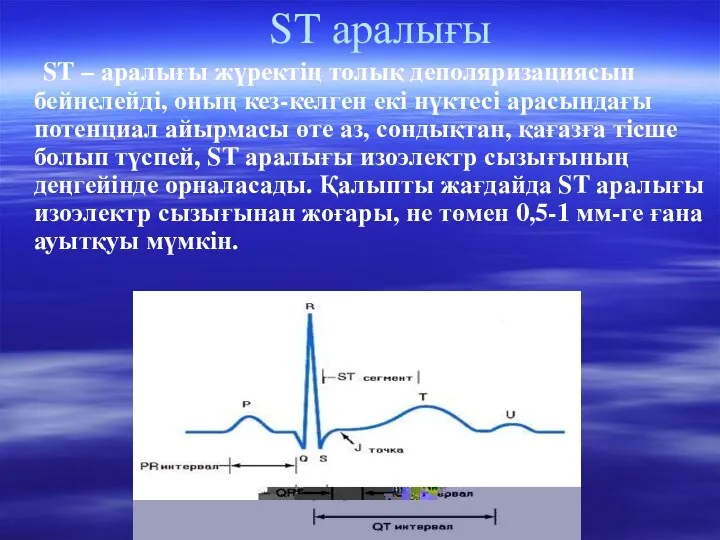 ST аралығы ST – аралығы жүректің толық деполяризациясын бейнелейді, оның