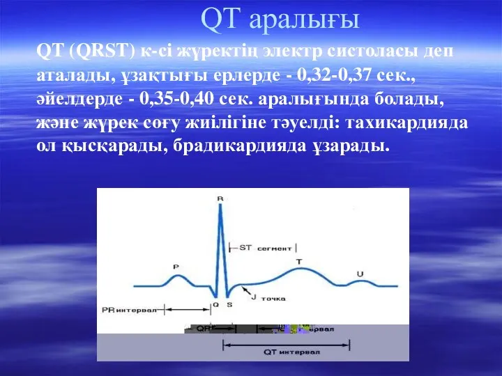 QТ аралығы QT (QRST) к-сі жүректің электр систоласы деп аталады,