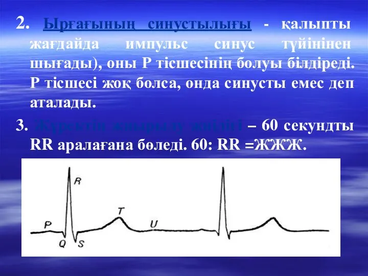 2. Ырғағының синустылығы - қалыпты жағдайда импульс синус түйінінен шығады),